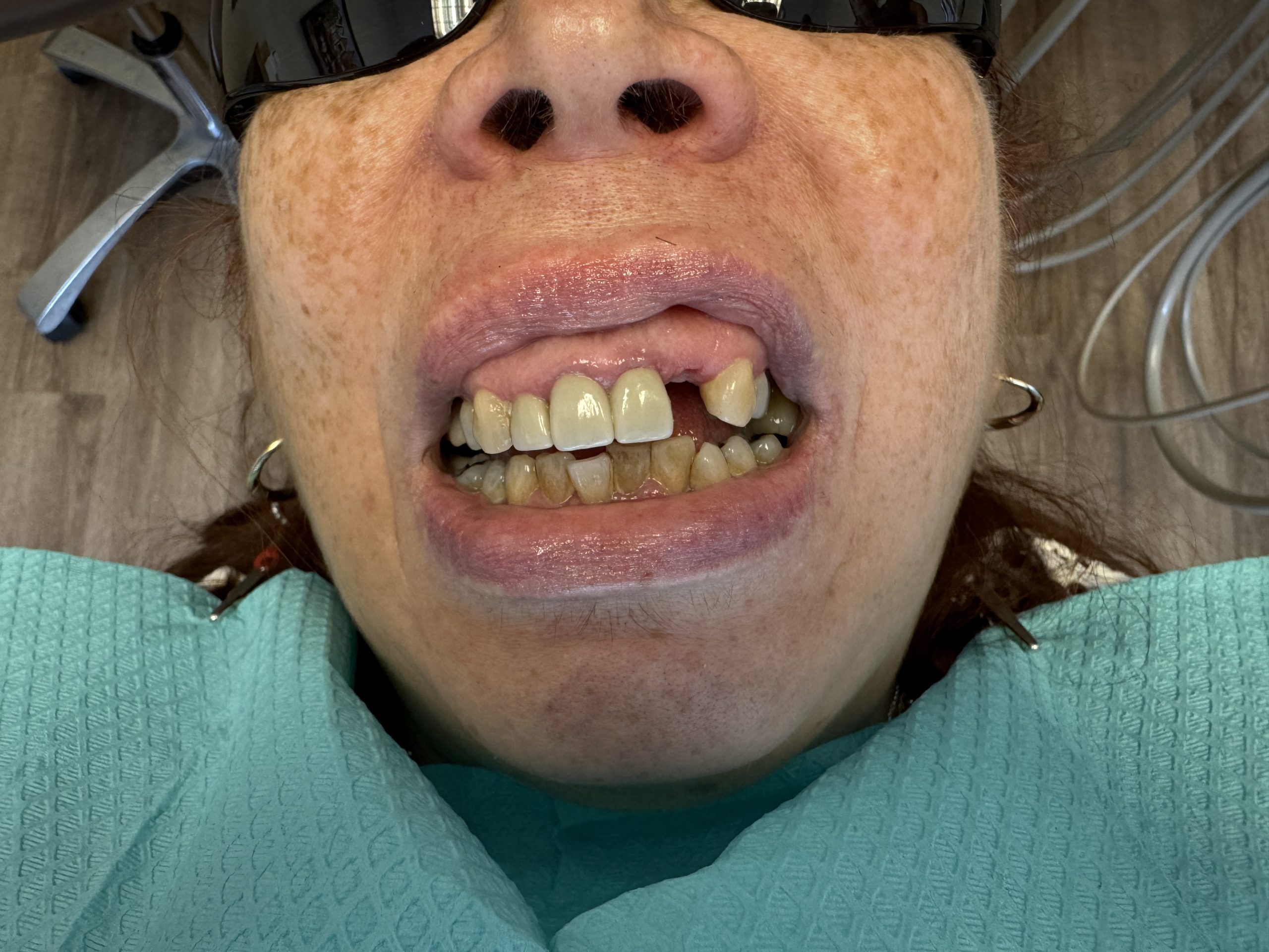 Before image