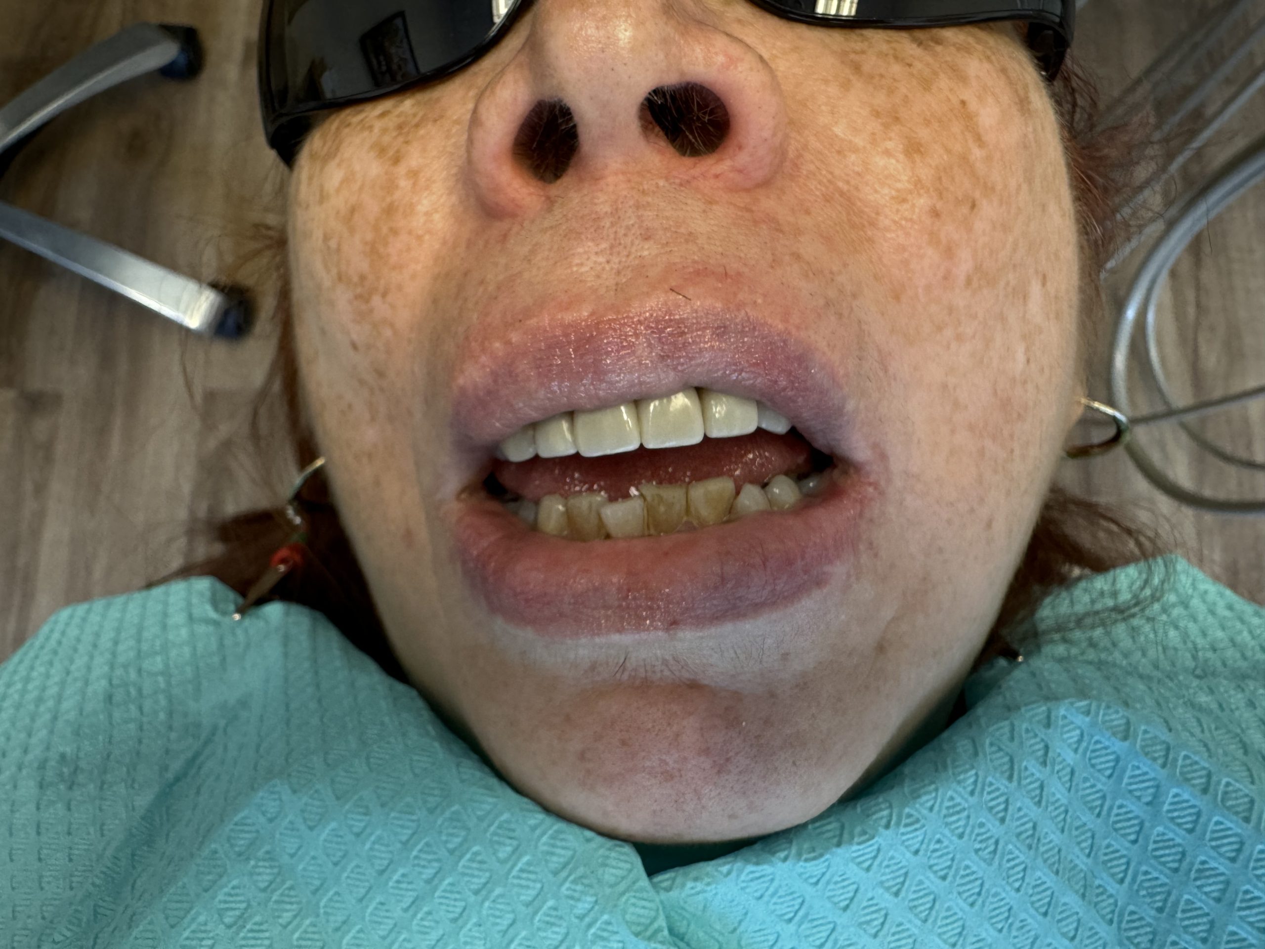 After image