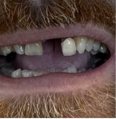 Before image